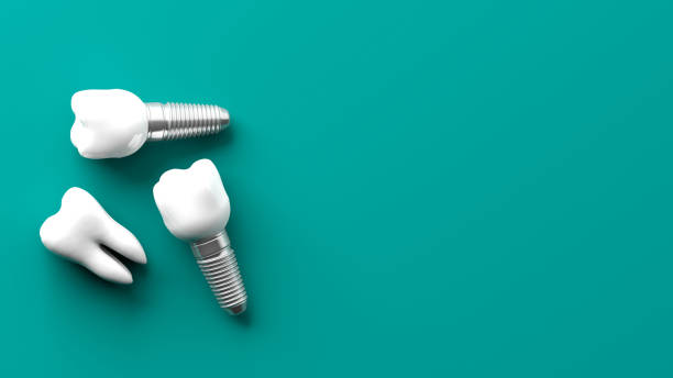 Dental implant models lying on a green background